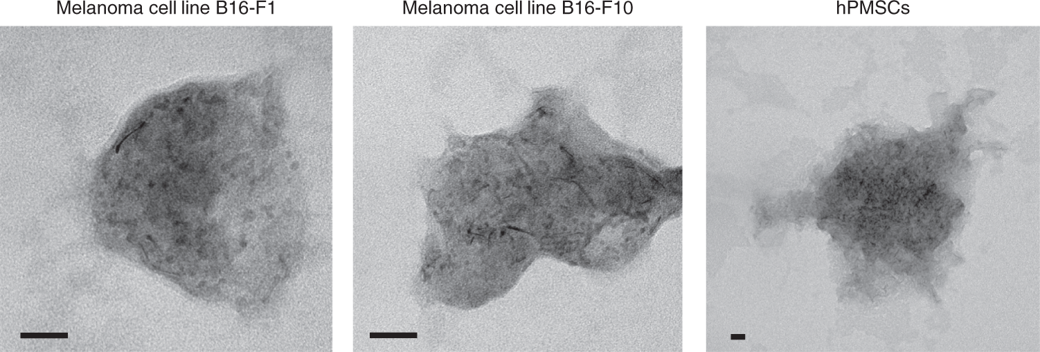 Fig. 7: Representative TEM images of Pd nanoengineered exosomes.