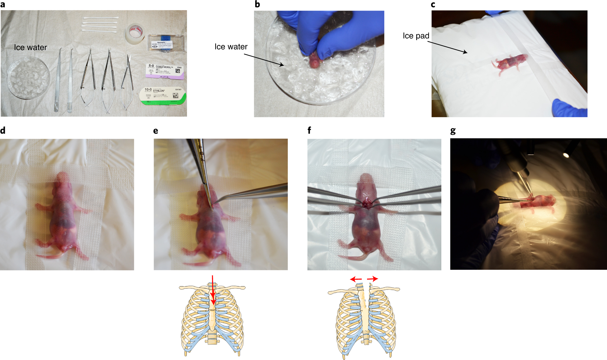 Fig. 1: Surgery setup.