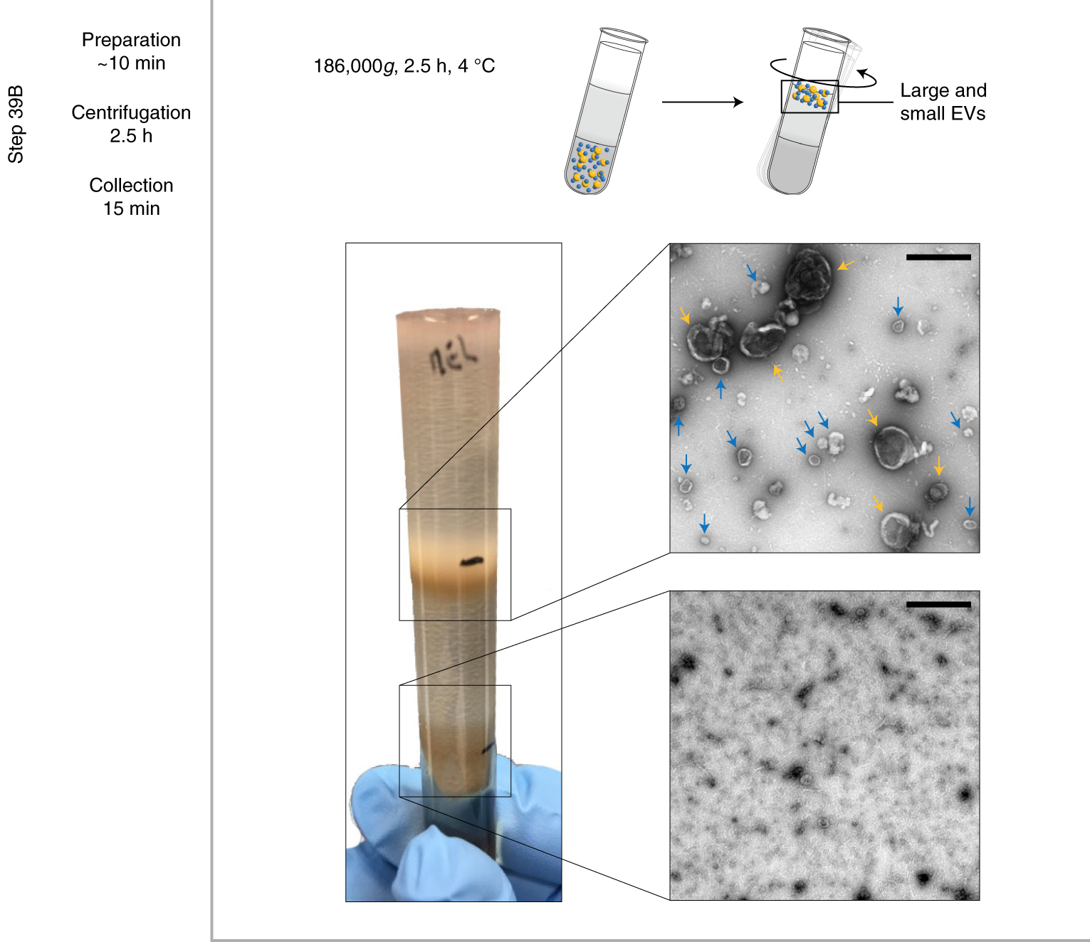 Fig. 4: Iodixanol cushion separation instead of discontinuous iodixanol gradient (Step 40B).