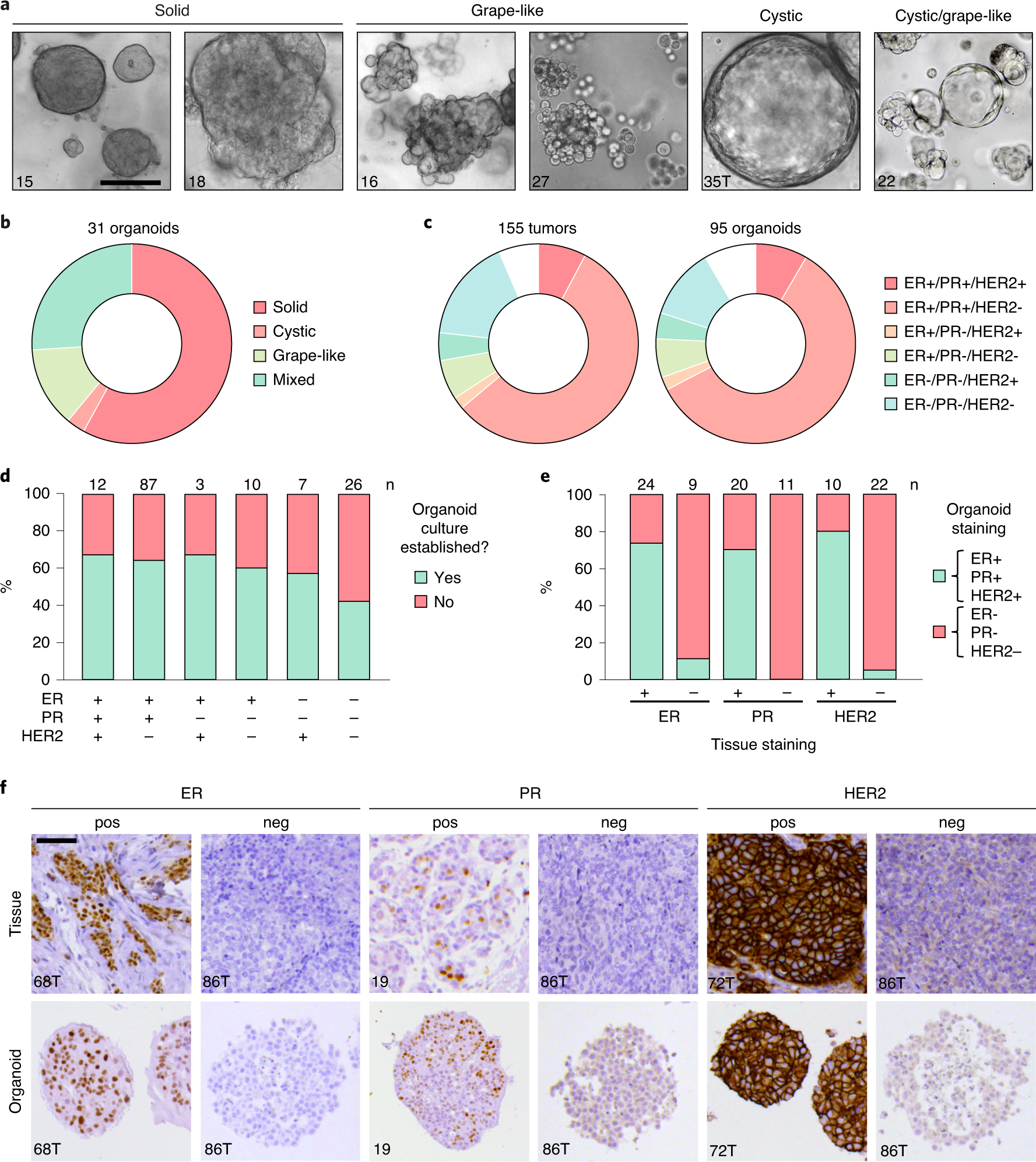 Fig. 5: Characterization of BC organoid cultures.