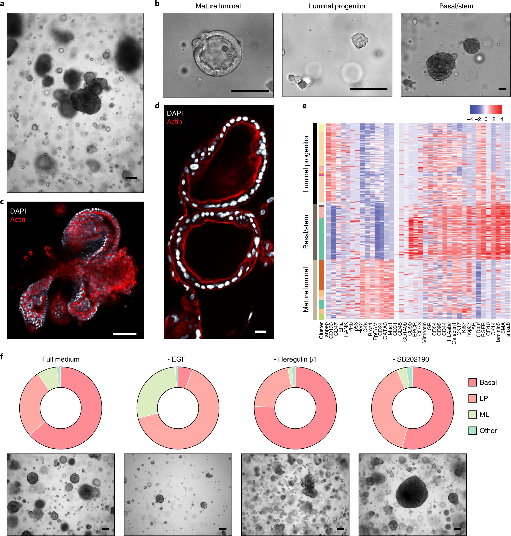 Fig. 6: Characteristics of breast organoid cultures derived from histologically normal breast tissues.