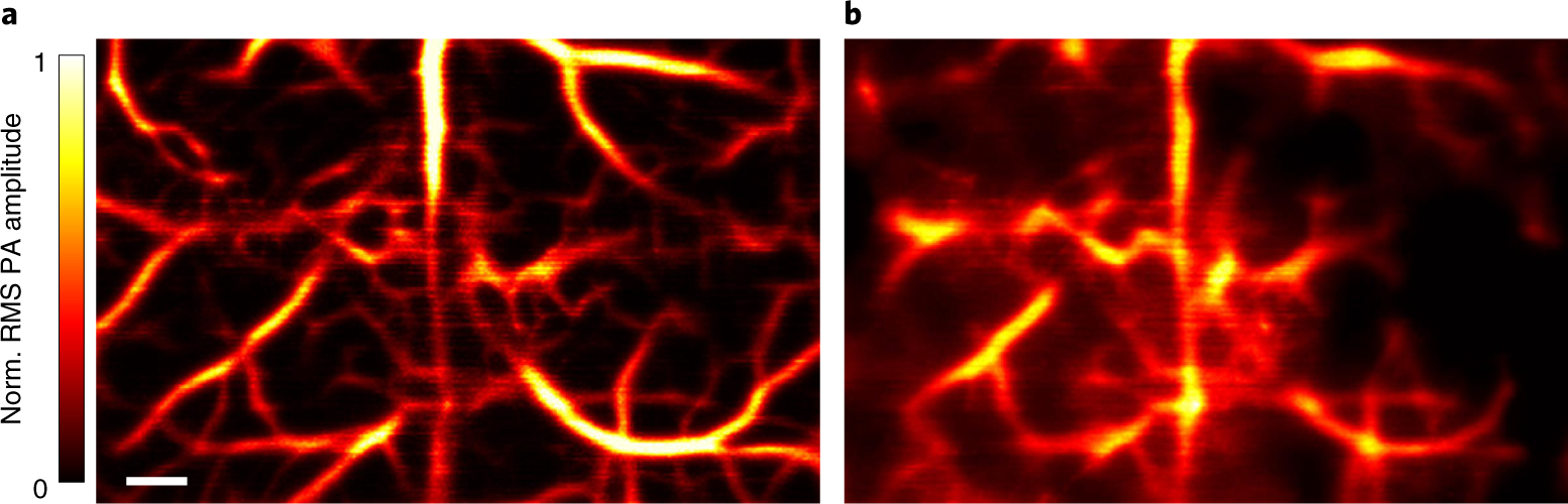 Fig. 3: PATER of the mouse cortical vasculature in vivo.