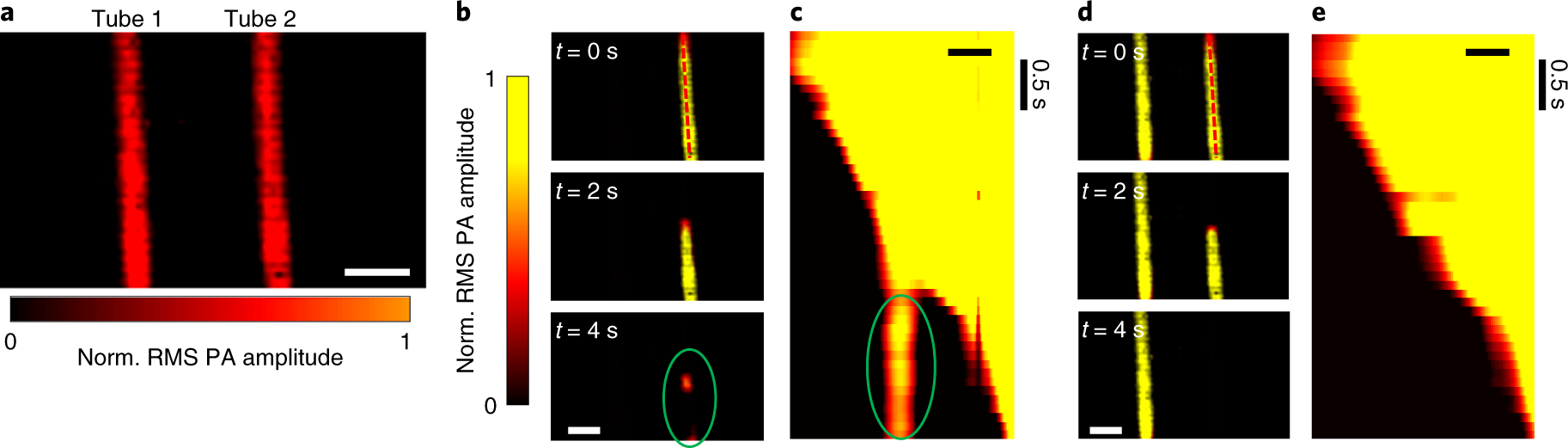Fig. 4: Reconstruction artifacts caused by signals from uncalibrated areas.