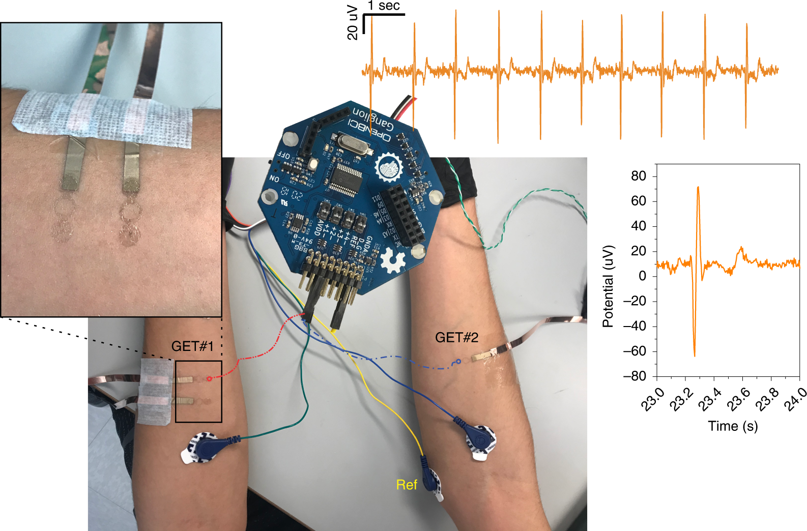 Fig. 13: ECG measurement setup via Open BCI ganglion board.