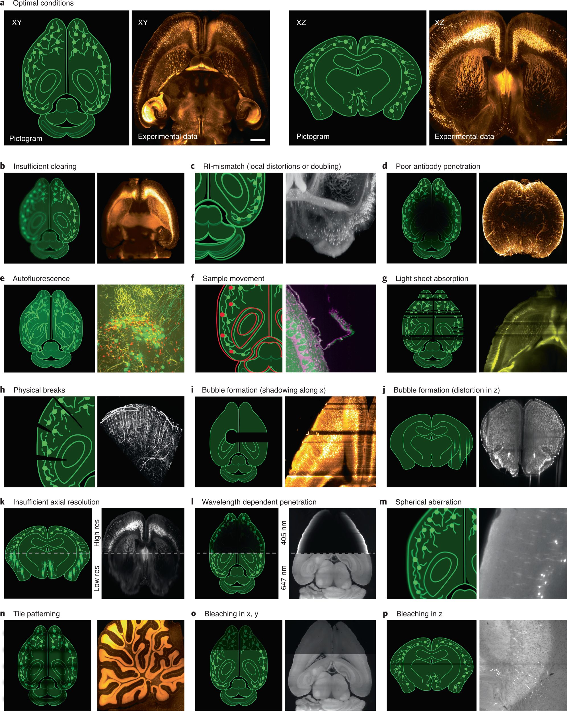 Fig. 3: Artifacts in cleared tissues imaged on light-sheet microscopes.