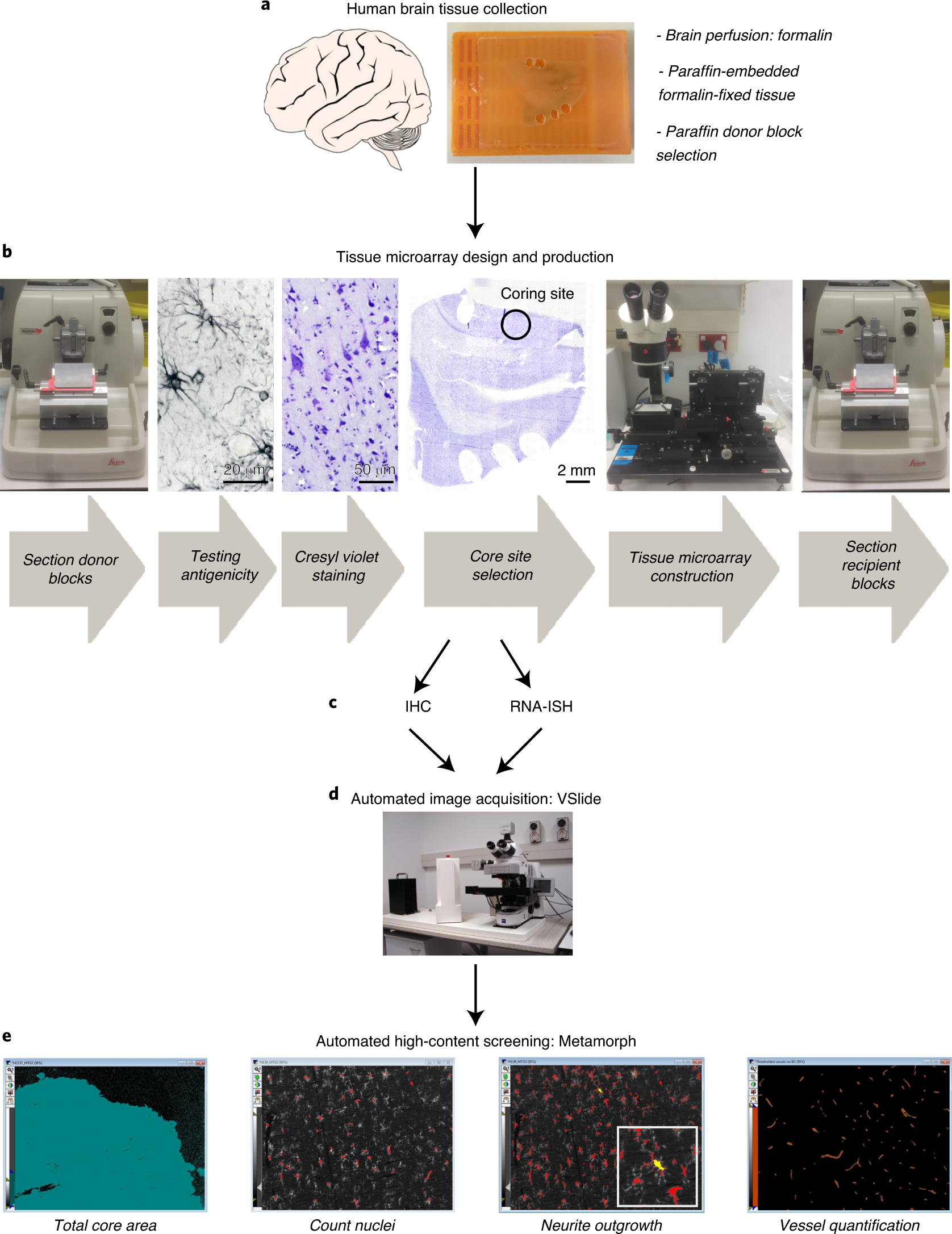Fig. 1: Overview of preparation, construction and high-throughput automated analysis of HBTMAs.