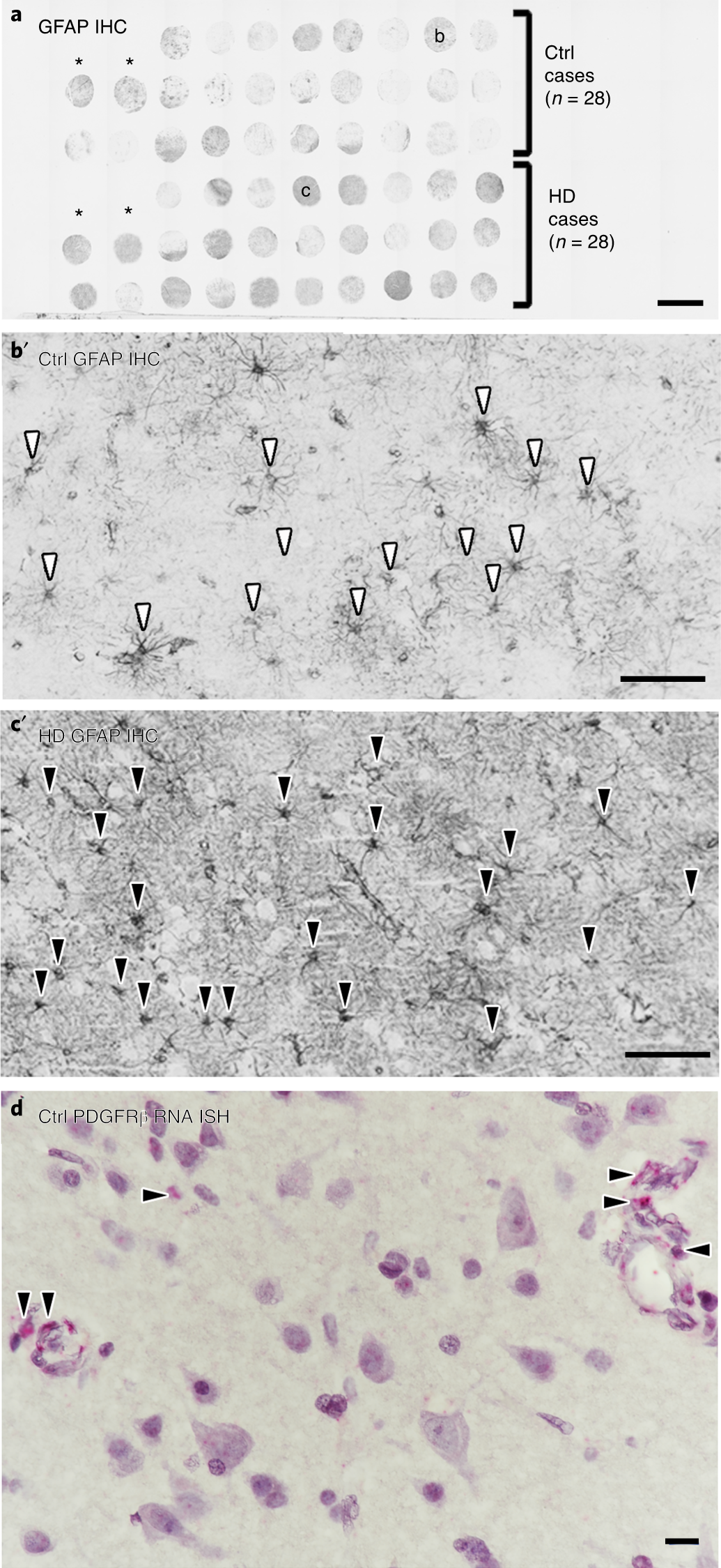 Fig. 3: Examples of IHC and ISH staining of a TMA.