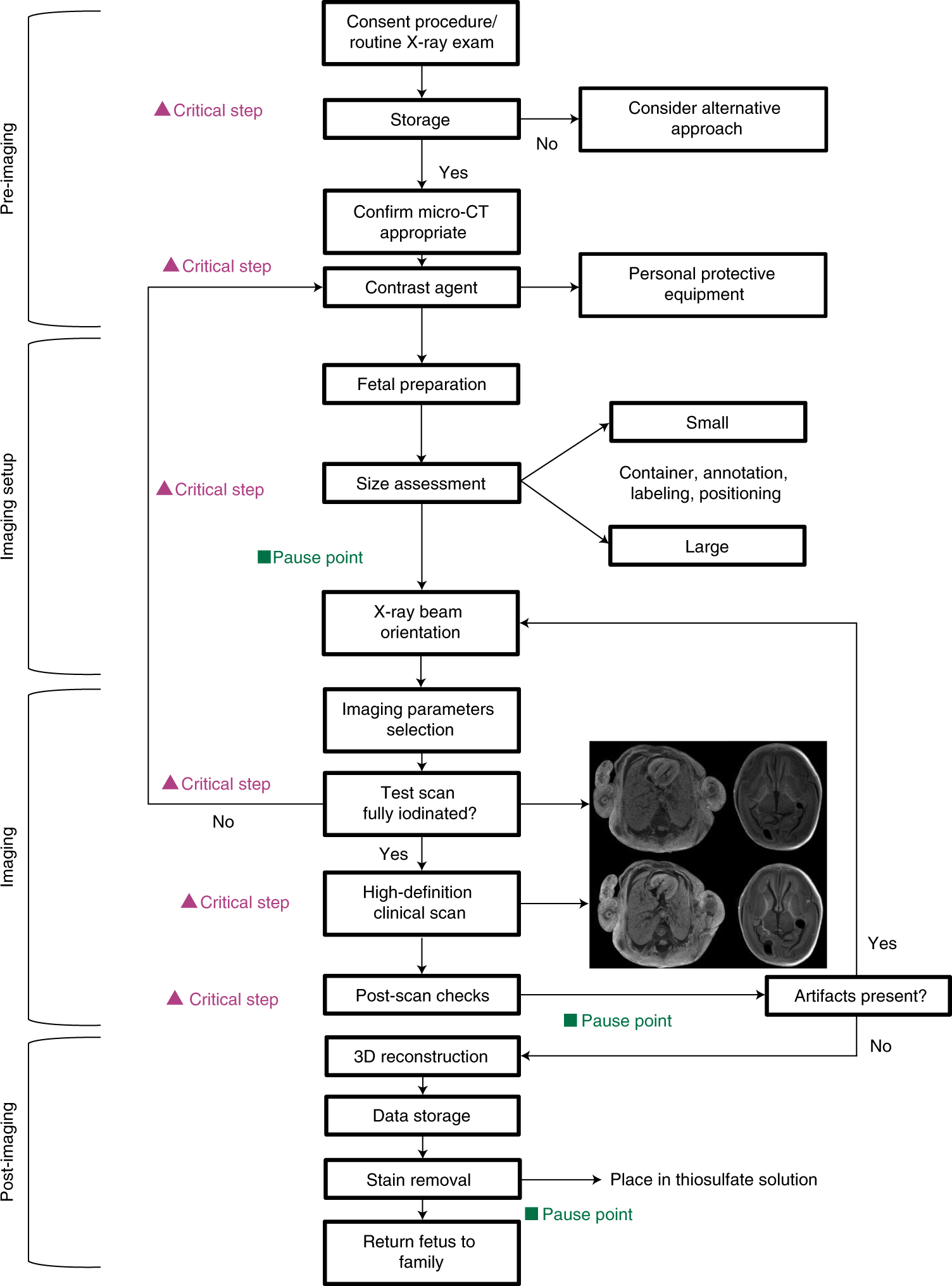 Fig. 2: Key parts of the workflow for human fetal whole-body postmortem microcomputed tomographic imaging.