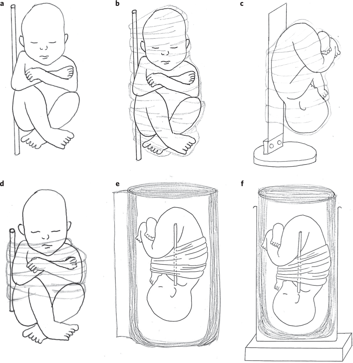 Fig. 4: Fetal preparation.