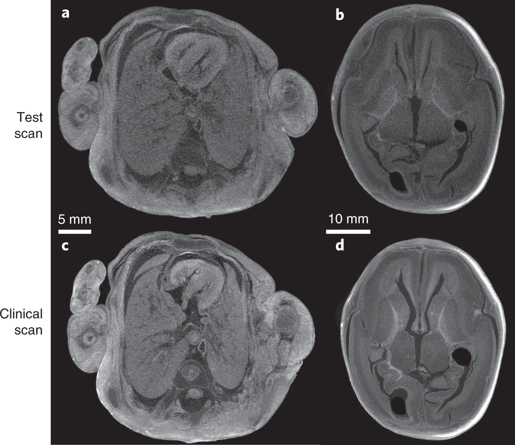 Fig. 6: Representative images of a fetus.