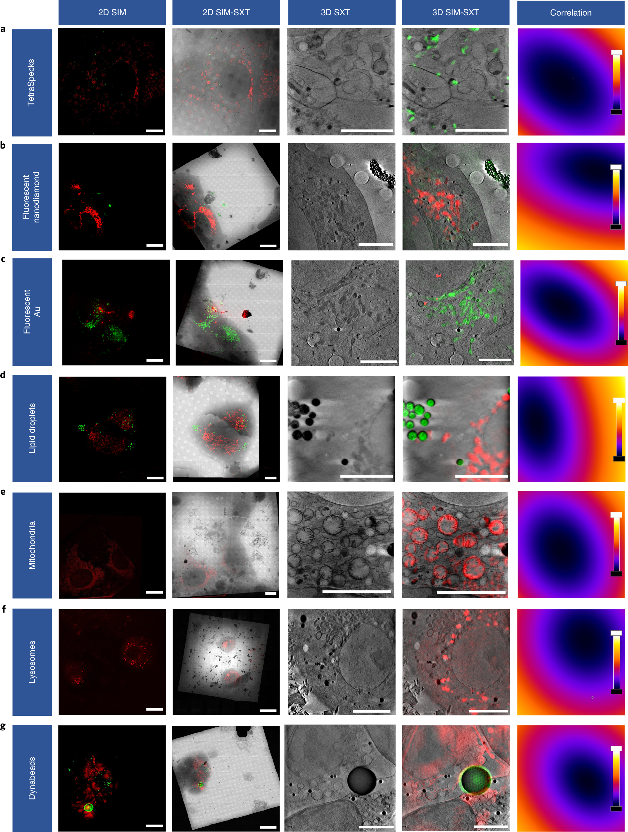 Fig. 2: Illustration of 2D (cryoSIM only and cryoSIM on X-ray mosaic) and 3D (cryoSXT only and cryoSIM with cryoSXT) correlation by using commercially available fiducial markers and organelle trackers.