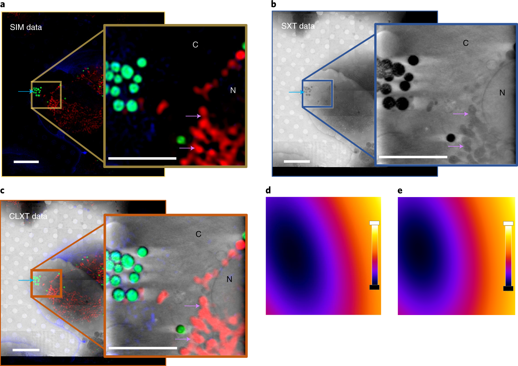 Fig. 4: Demonstration of correlation of fluorescence and X-ray data in U2OS cells by using green lipid droplets as fiducial markers.