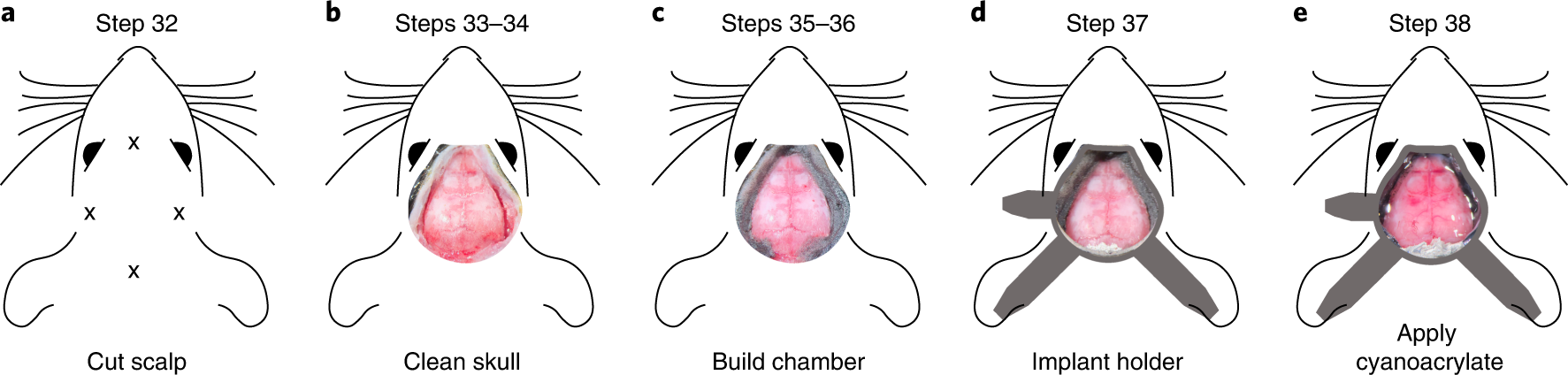 Fig. 5: Overview of the surgical procedures.