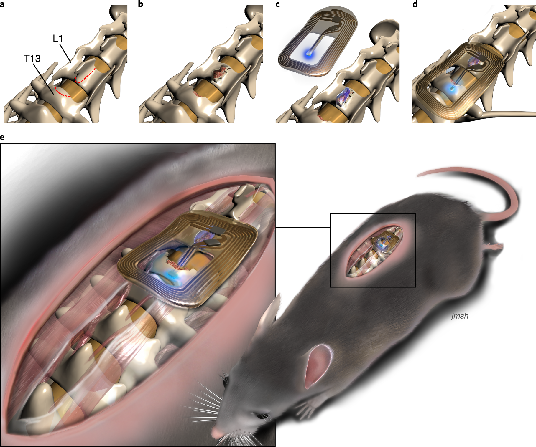 Fig. 2: Graphical representation of the surgical procedure for implantation of the spinal µLED device.