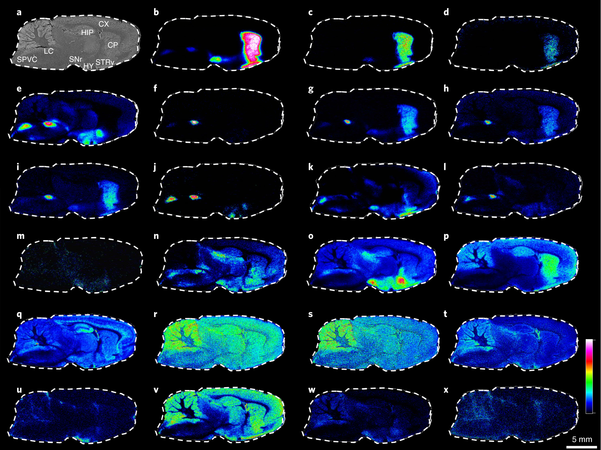 Fig. 3: MALDI-MSI analysis of neurotransmitters, metabolites and amino acids facilitated by on-tissue FMP-10 derivatization.