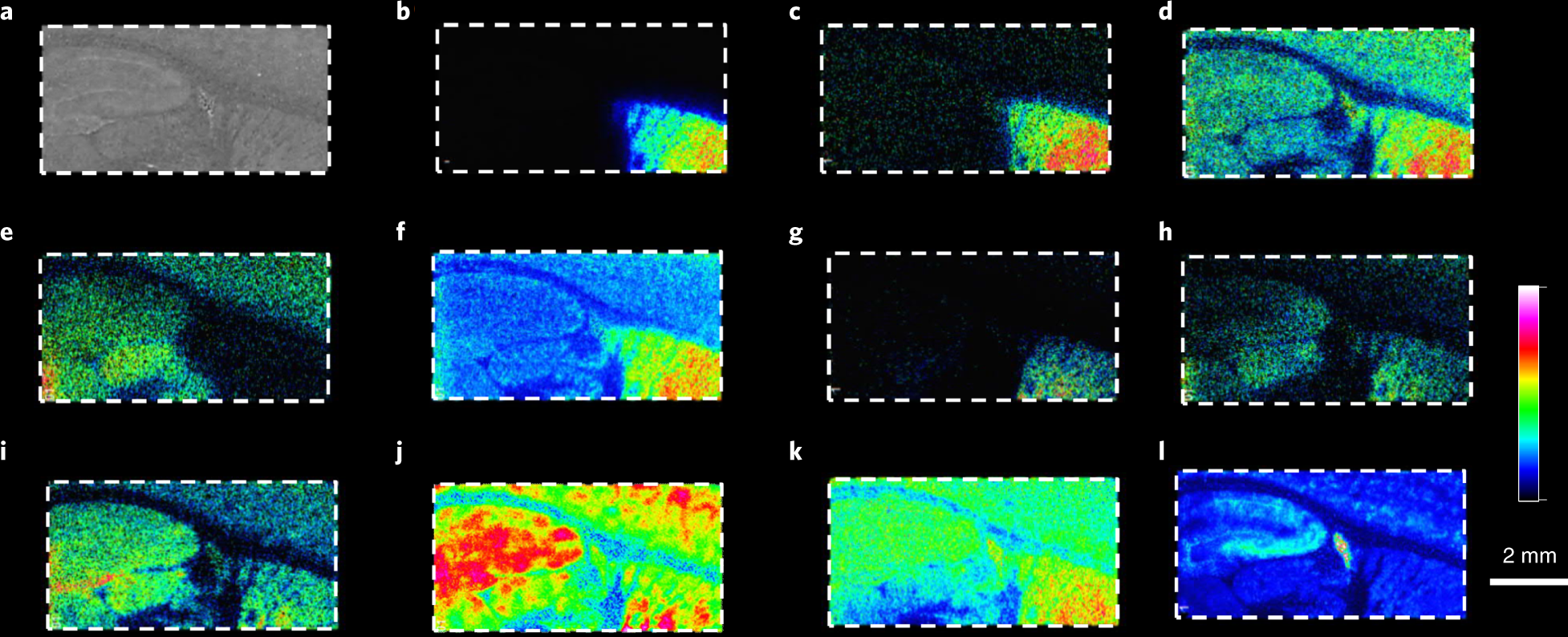 Fig. 4: High-resolution MALDI-MSI analysis of a rat brain tissue section after on-tissue derivatization with FMP-10.