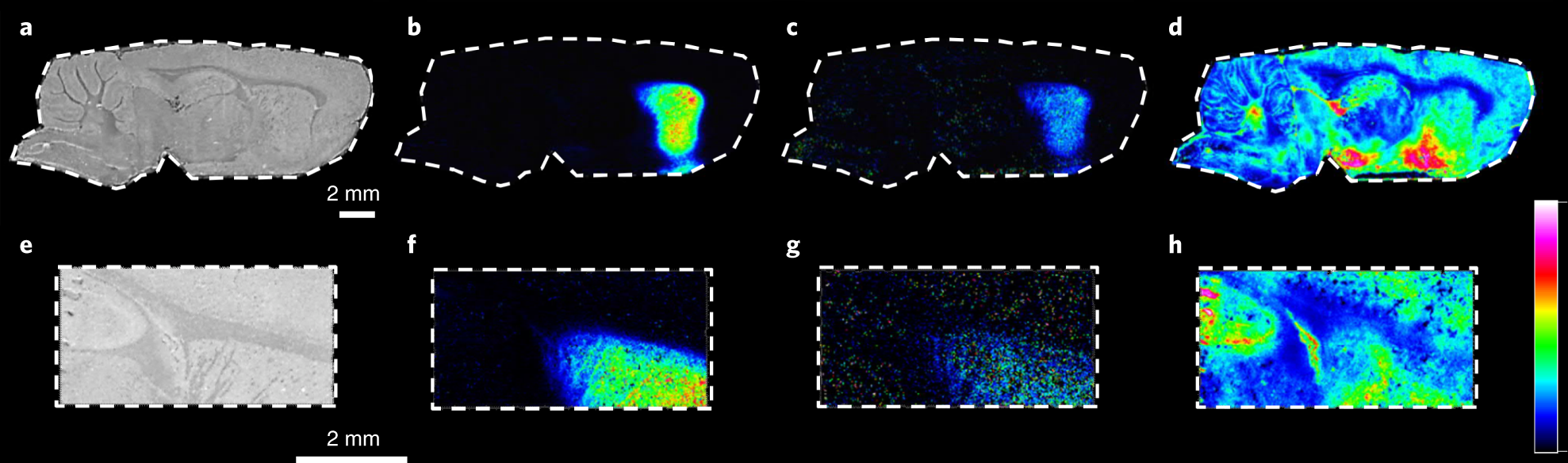 Fig. 5: MALDI-MSI analysis of neurotransmitters facilitated by on-tissue derivatization with DPP.
