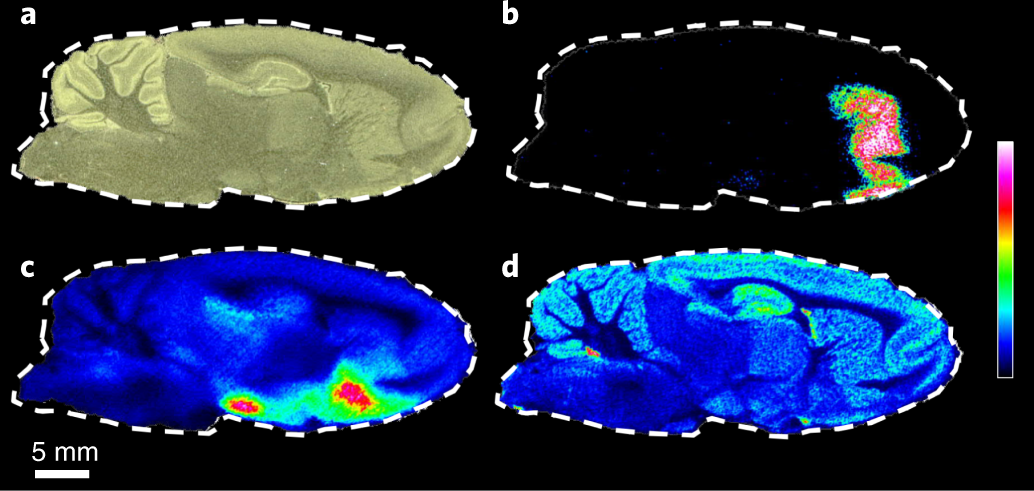Fig. 6: DESI-MSI analysis of neurotransmitters facilitated by on-tissue derivatization by FMP-10.