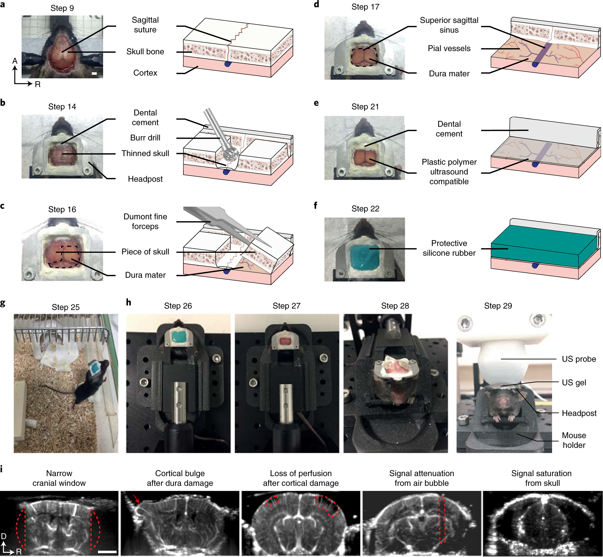 Fig. 2: Surgical procedure for chronic whole-brain imaging of awake head-fixed mice.