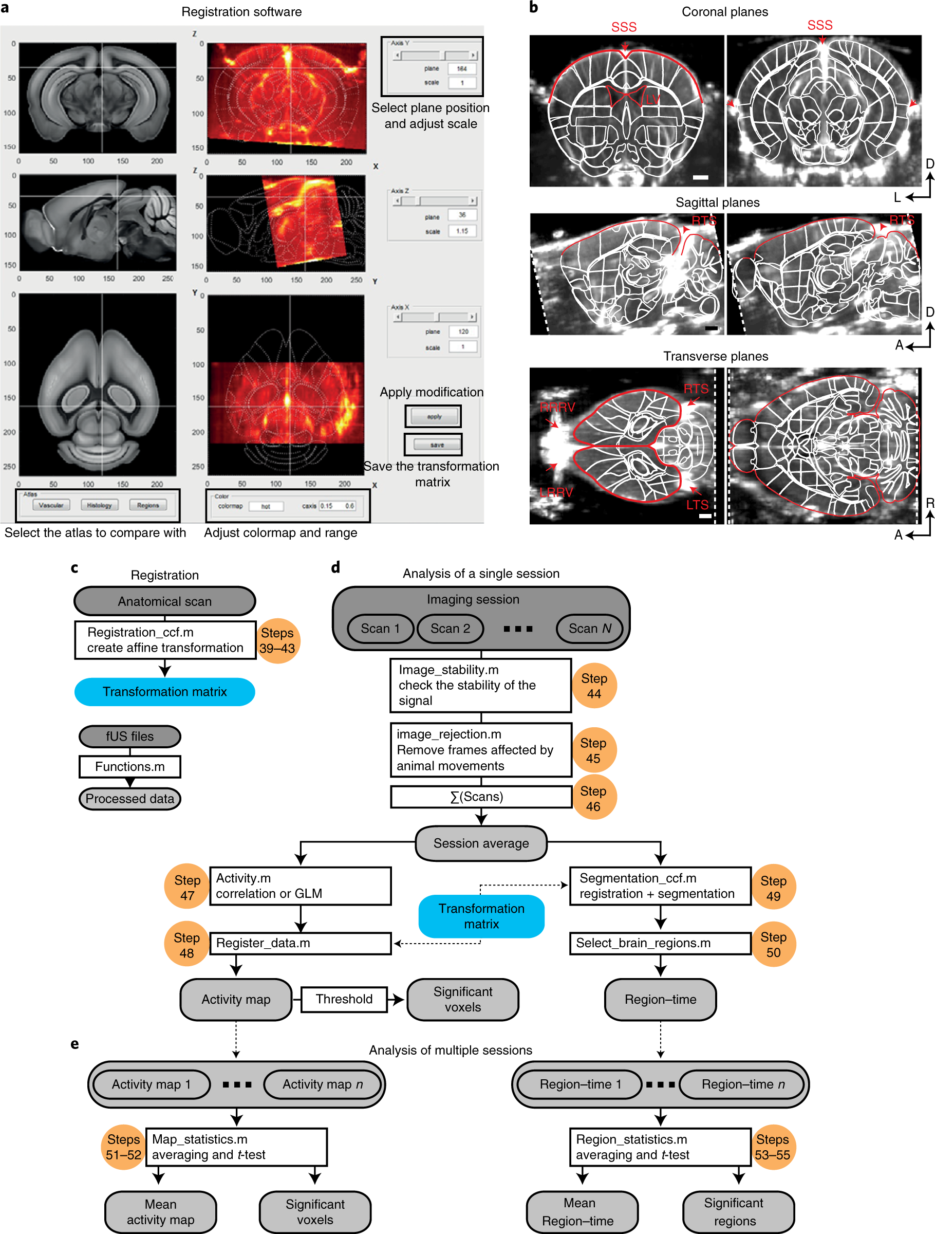Fig. 4: Registration and processing of whole-brain fUS data.