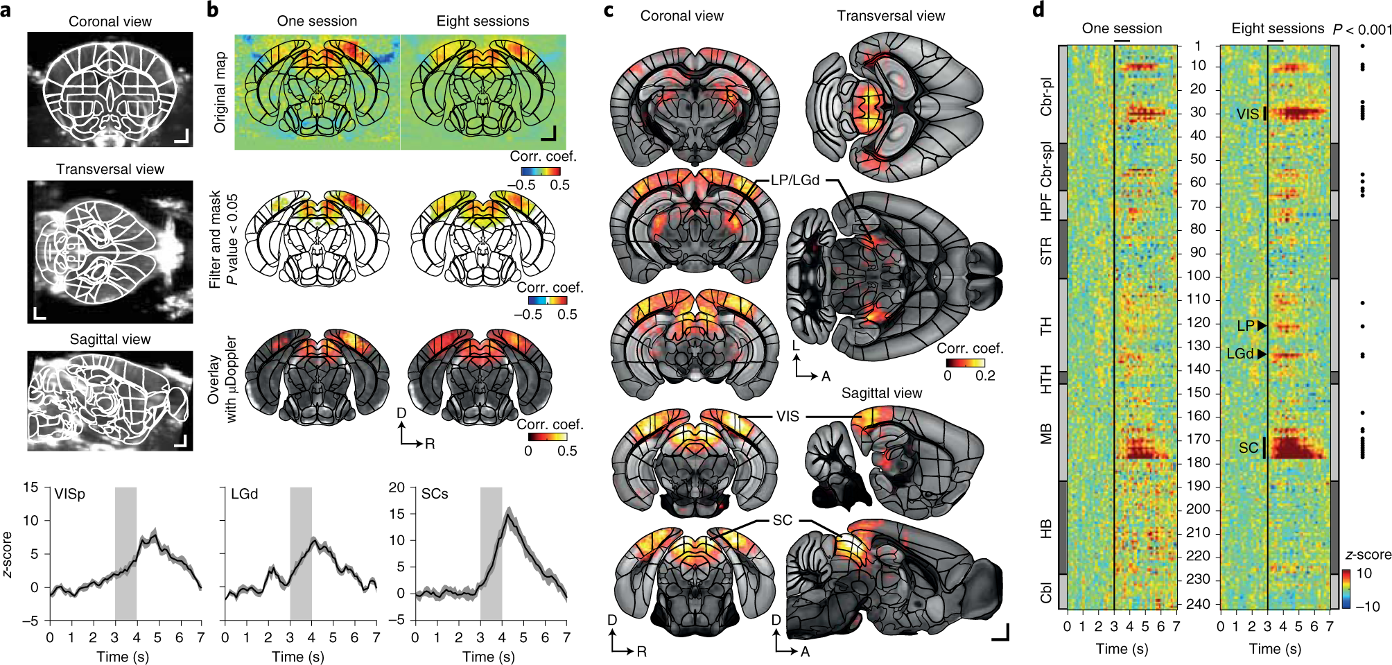 Fig. 6: Example of processed whole-brain fUS data.