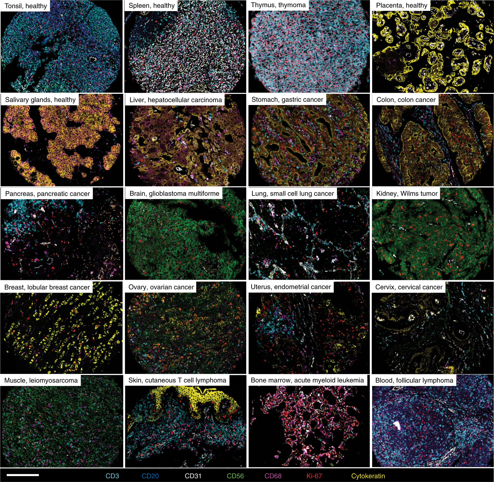 Fig. 3: Human FFPE tissues imaged with CODEX.