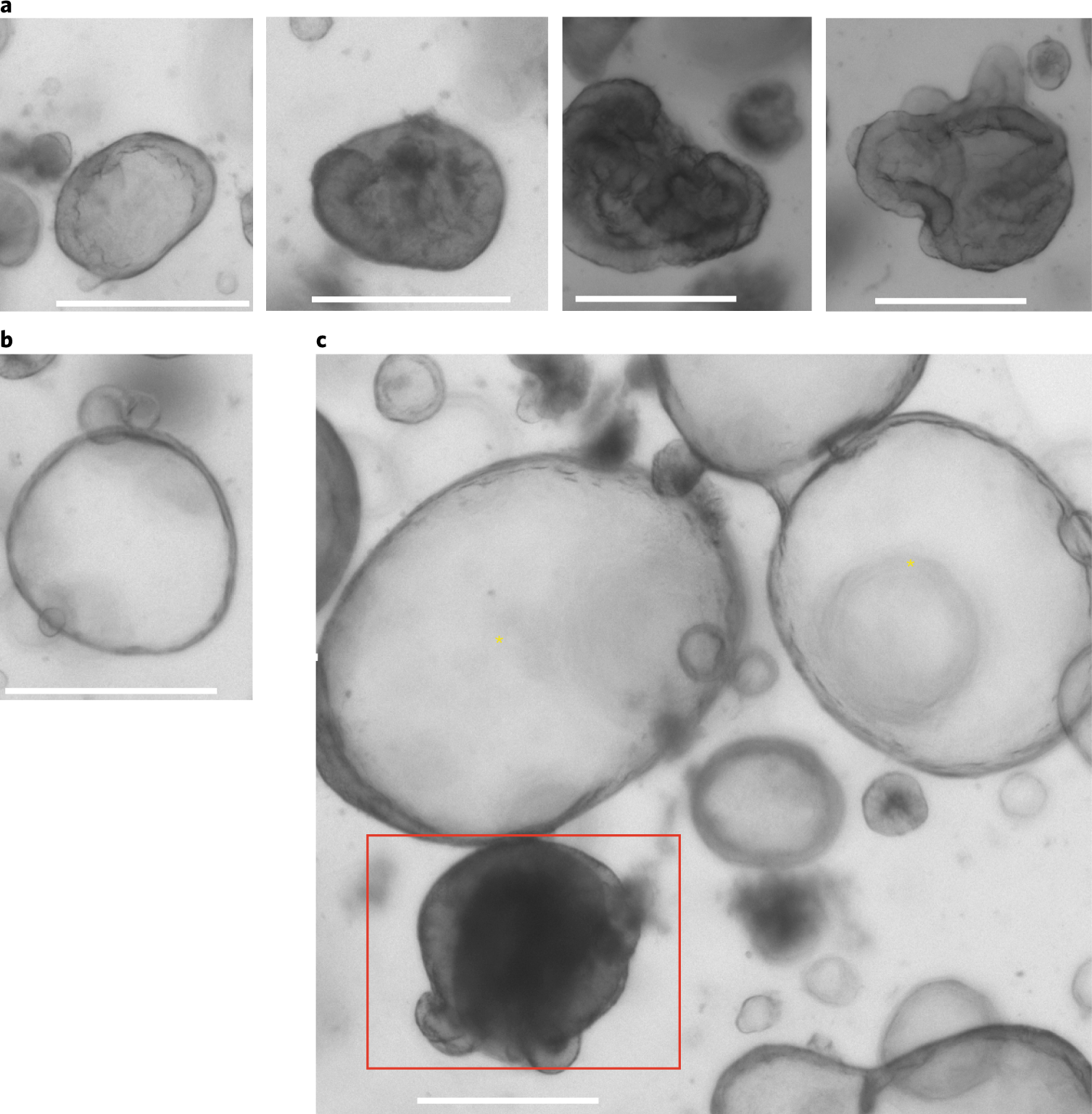 Fig. 3: Morphology of primary human colon organoids.