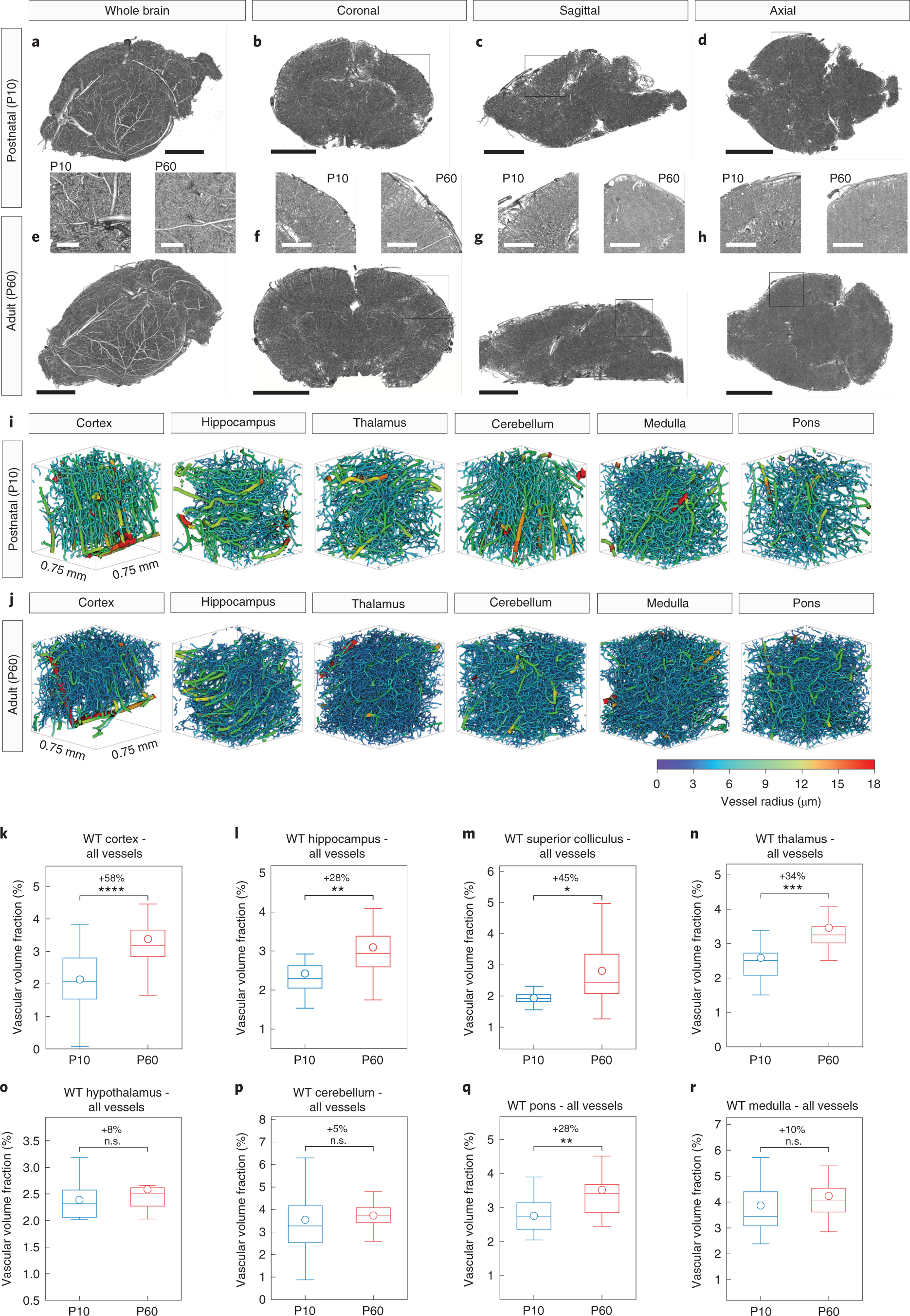 Fig. 13: High-resolution SRµCT scan of the entire postnatal (P10) and adult (P60) mouse brain: visualization and quantification of various anatomical brain regions reveals increased vascular volume fractions in the P60 versus P10 mouse brain.