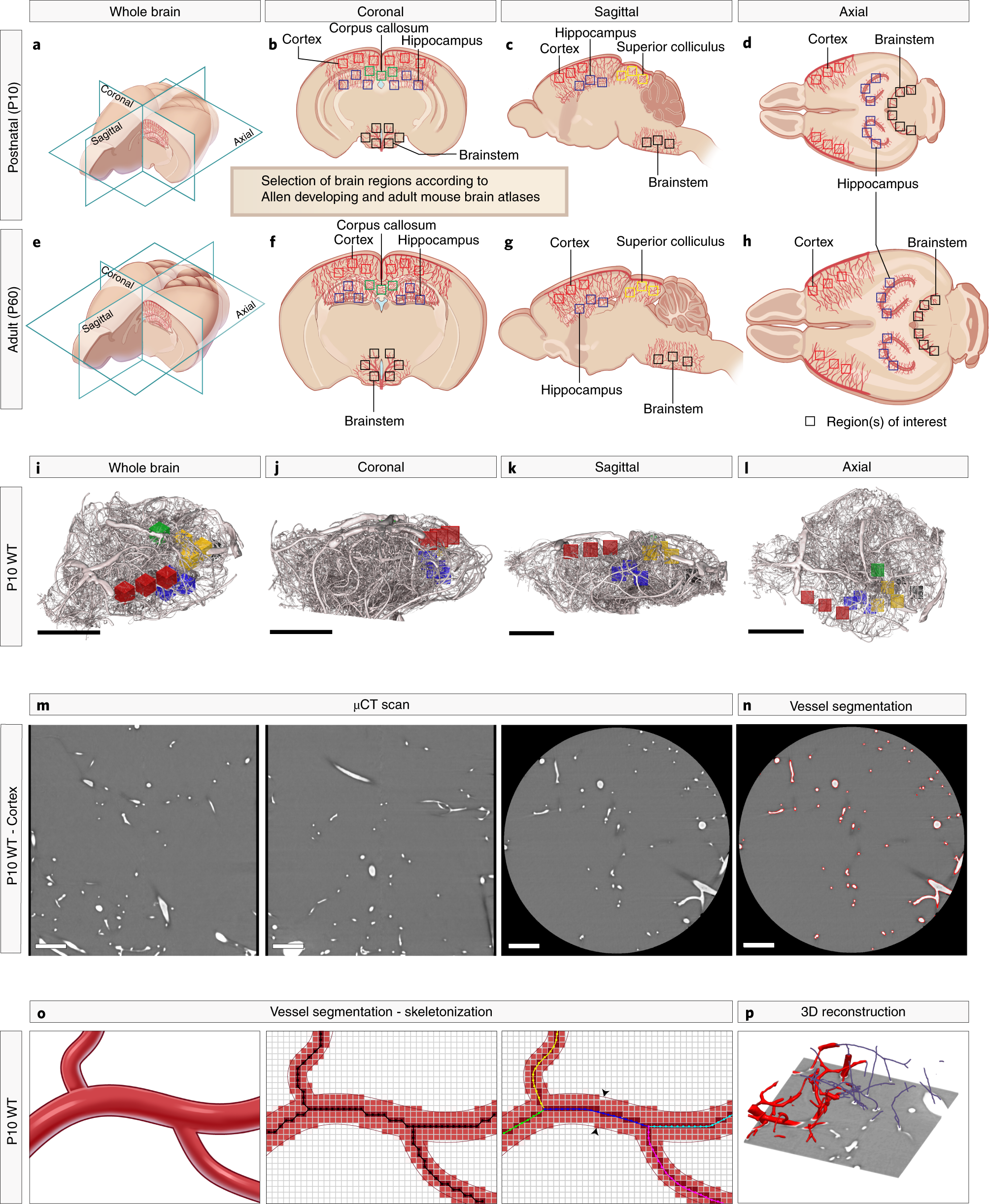 Fig. 4: The placement of the ROIs and process of computational 3D reconstruction.