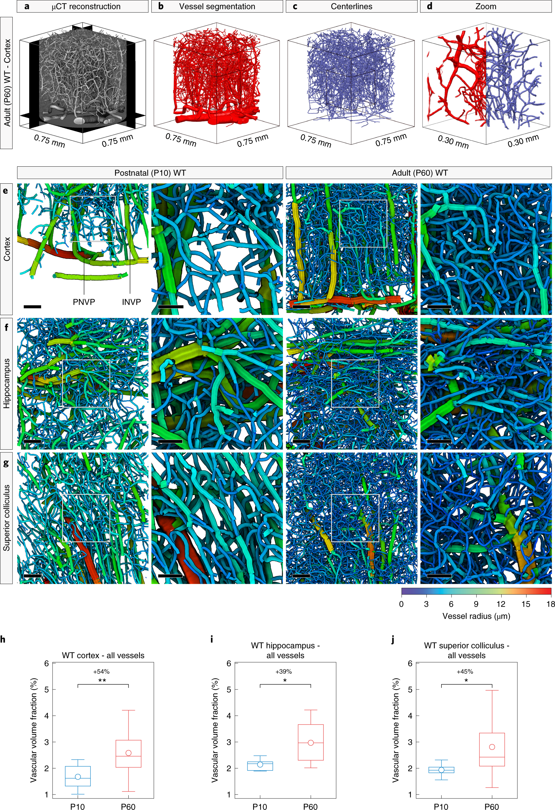Fig. 5: Global vascular network morphometry: increased vascular volume fraction in various regions of the adult (P60) WT versus postnatal (P10) WT mouse brain.