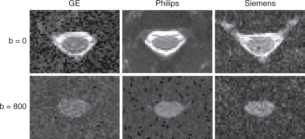 Fig. 11: Axial views of good quality data for DWI scans at b = 0 s/mm2 (top row) and b = 800 s/mm2 (bottom row).