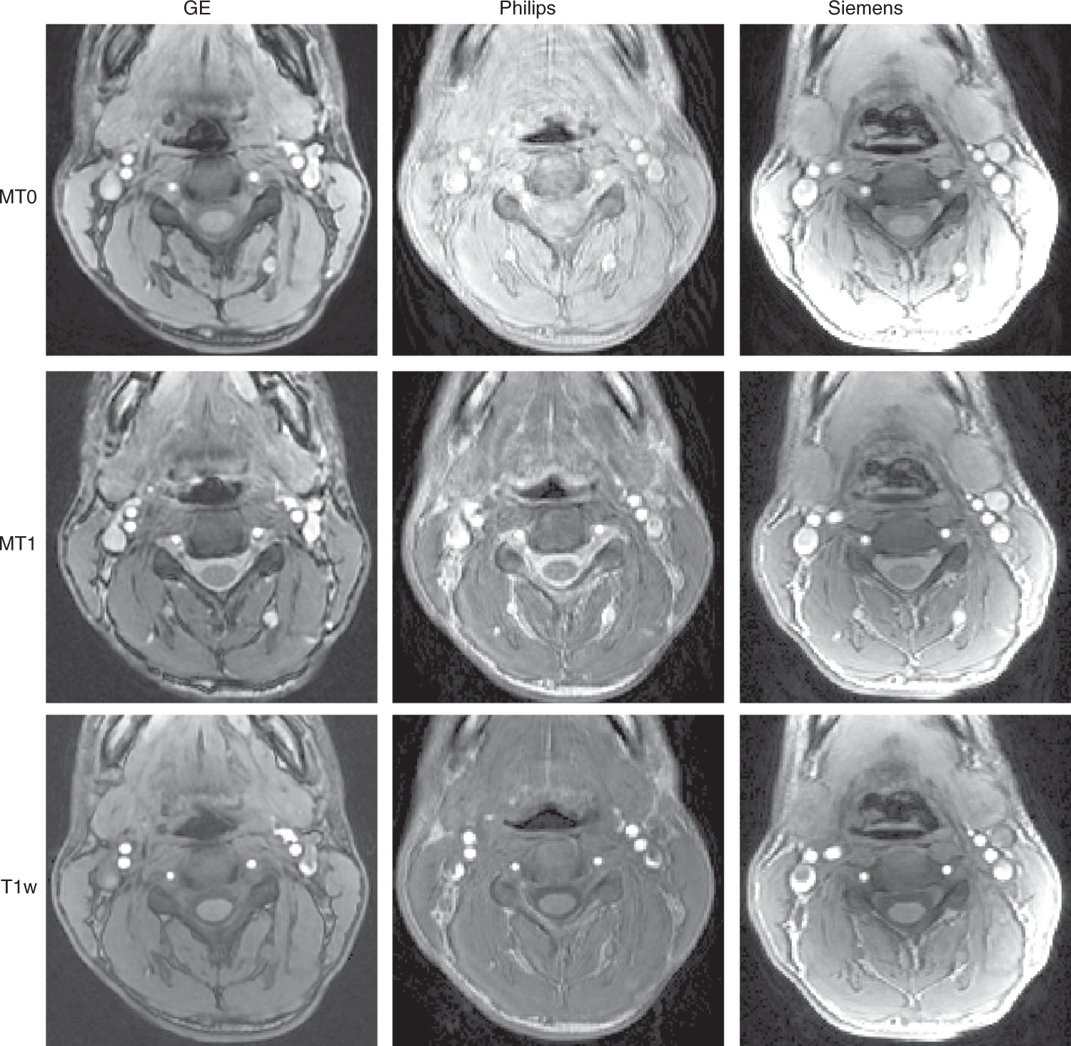 Fig. 12: Axial views of good-quality data for MT0, MT1 and T1w scans.