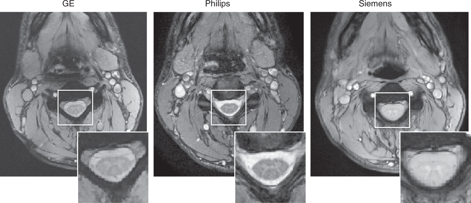Fig. 13