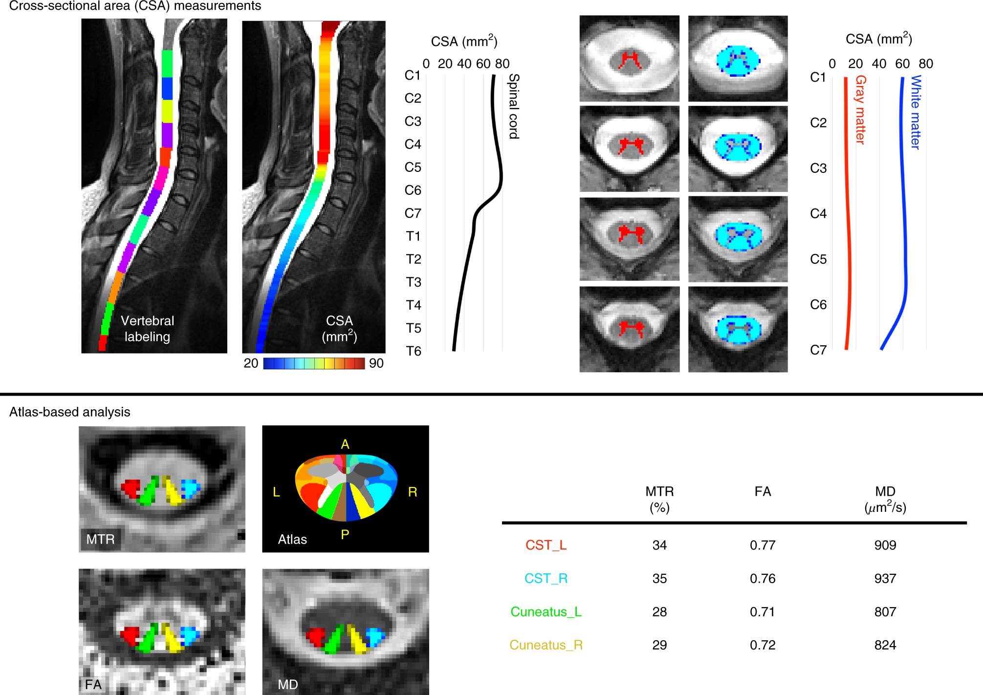 Fig. 1: Illustration of the MRI metrics that could be extracted from the spine generic protocol.
