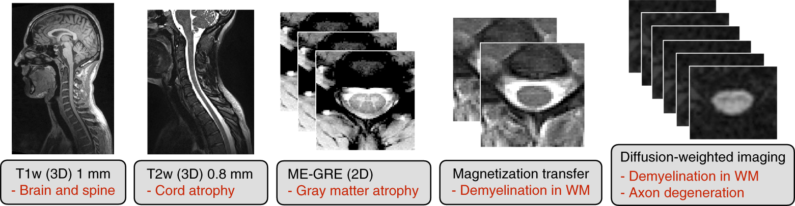 Fig. 2: Sequences included in the spine generic protocol (in black) with possible applications (in red).
