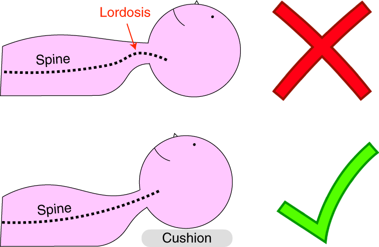 Fig. 3: Patient positioning.