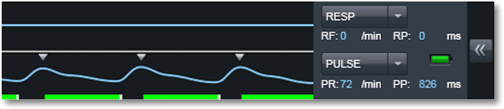 Fig. 7: Checking a pulse oximeter trace.