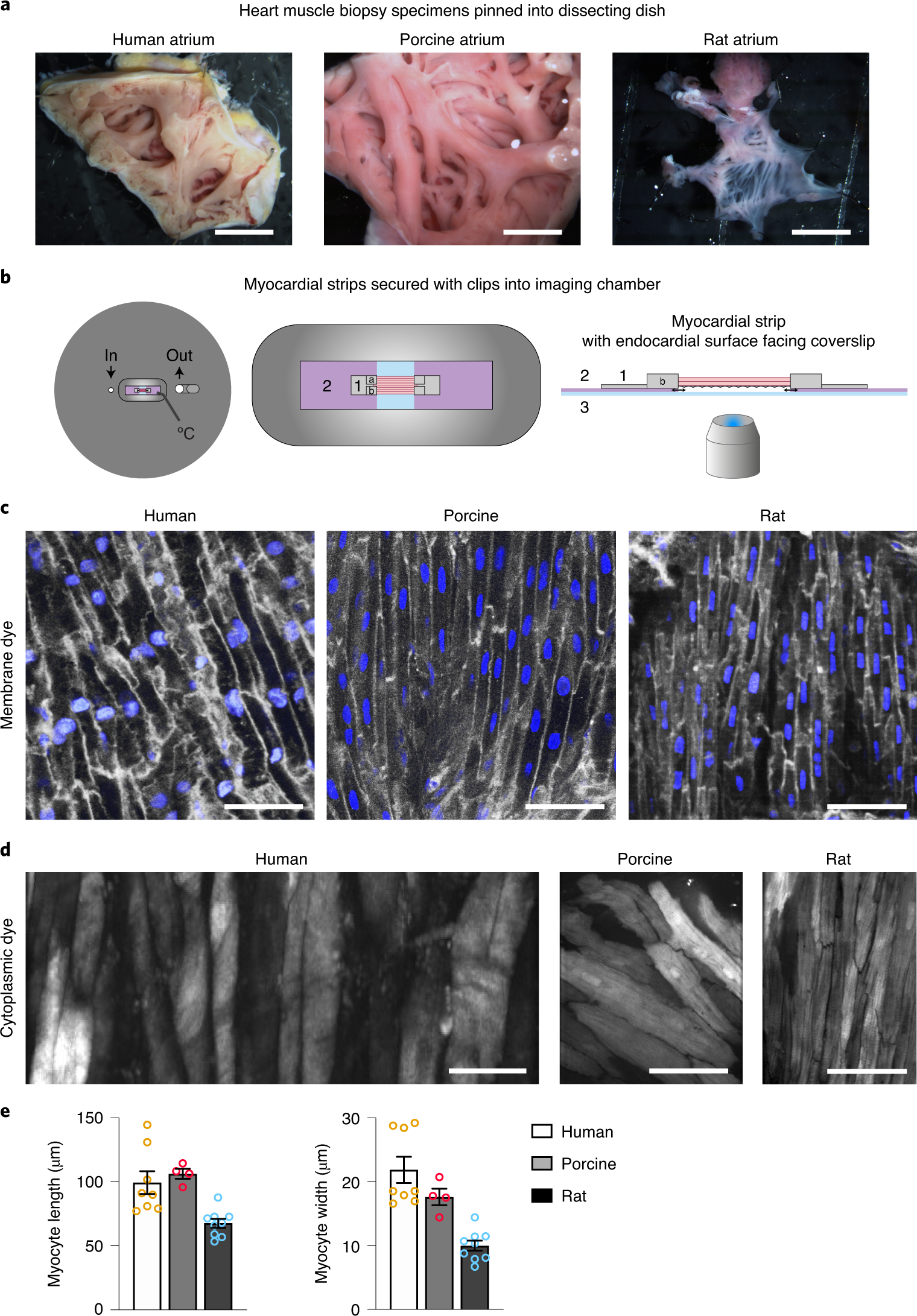 Fig. 2: Dissection, mounting and imaging myocardial strips.