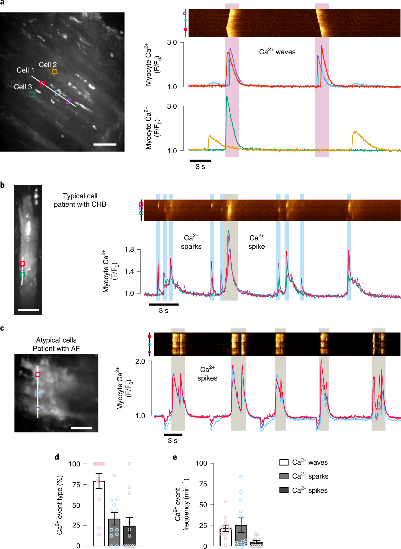 Fig. 3: Spontaneous Ca2+ events in human atrial cardiomyocytes.