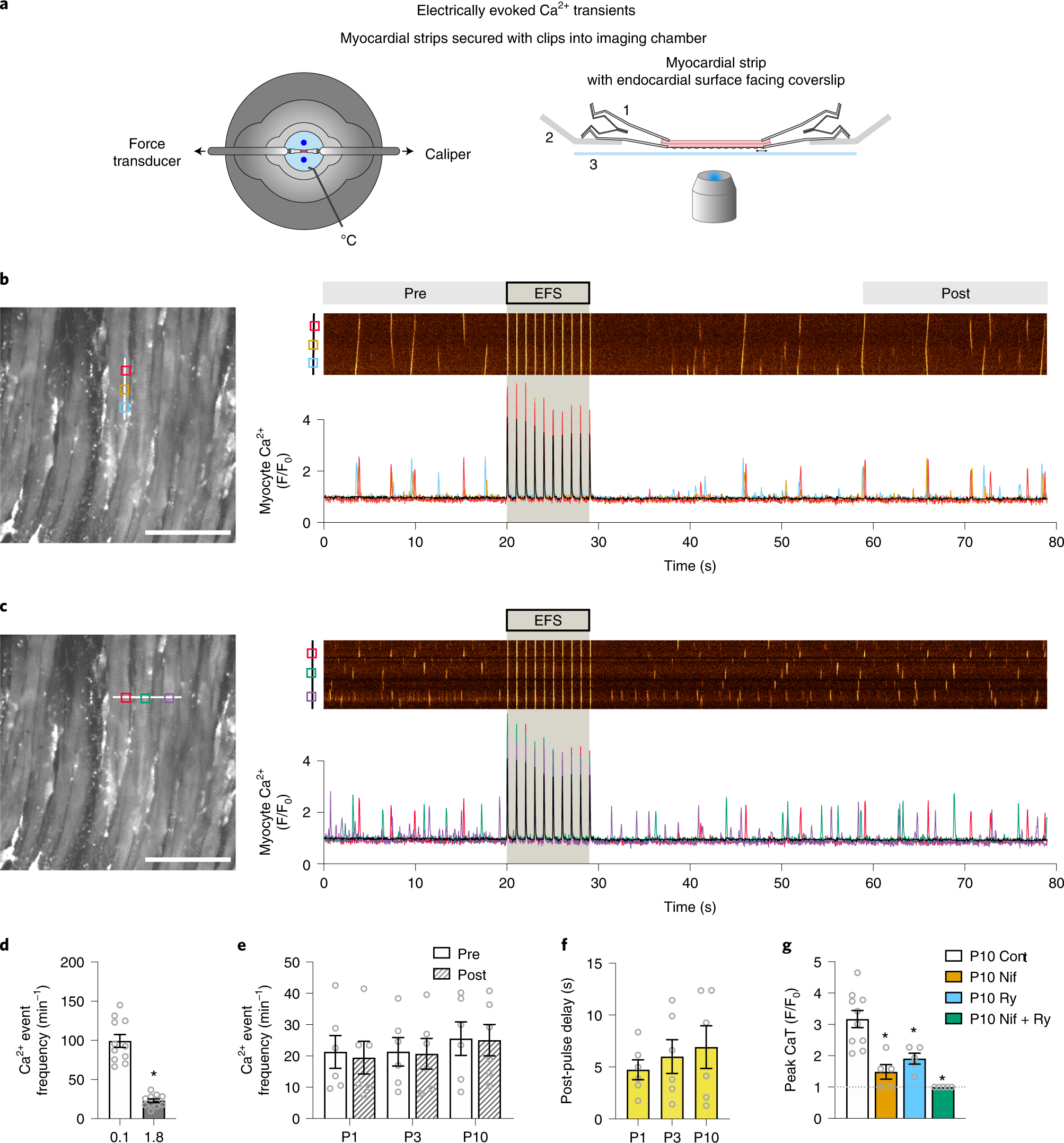 Fig. 6: Ca2+ transients (CaTs) in rat atrial cardiomyocytes.