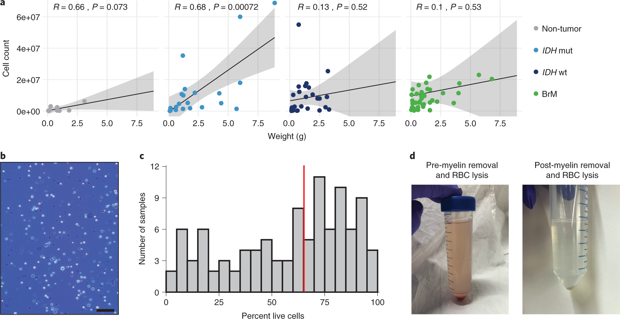Fig. 3: Variation in immune cell abundance and cell viability across different brain (tumor) tissue types.
