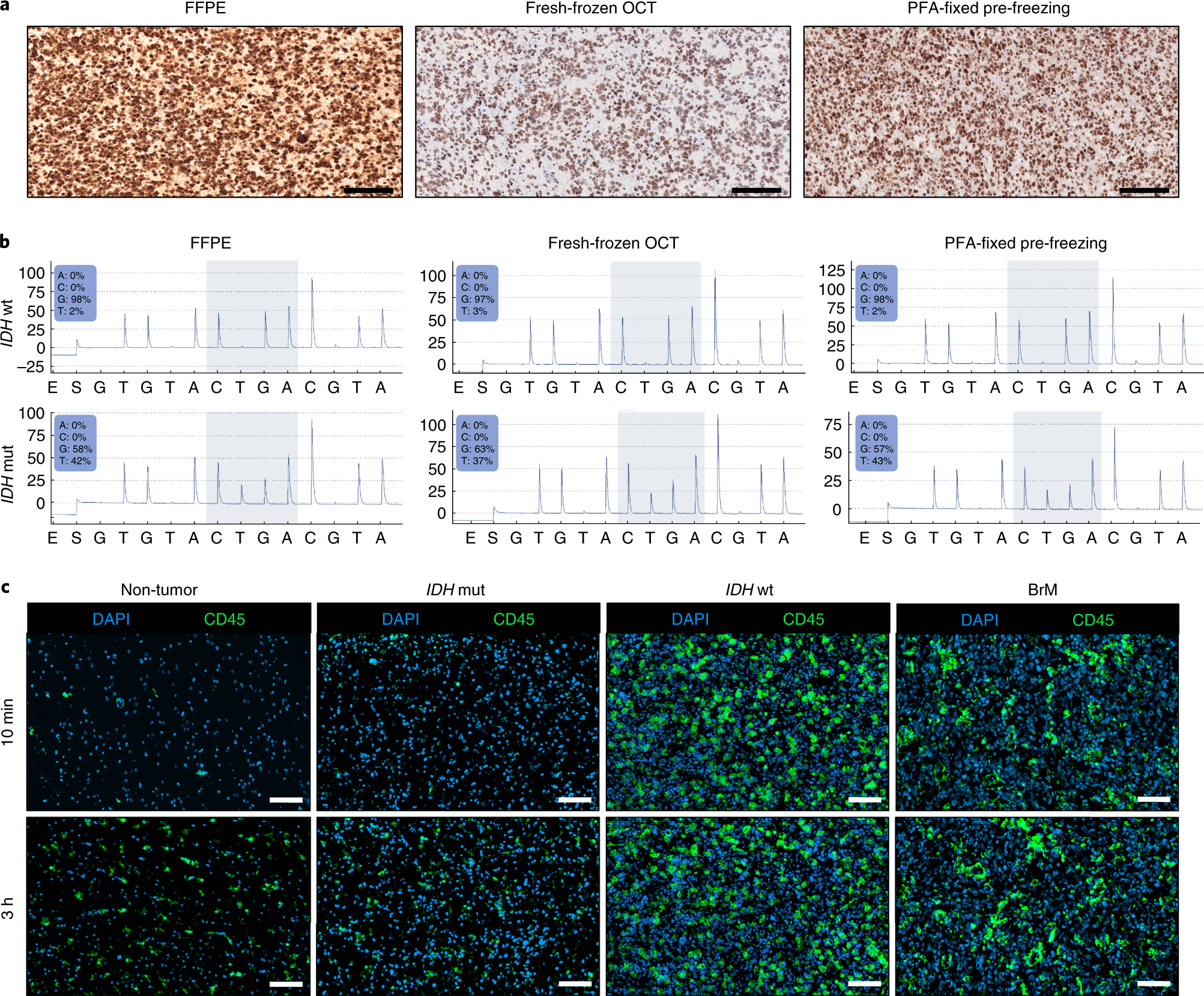 Fig. 4: Examples of IF staining across different brain (tumor) tissues.