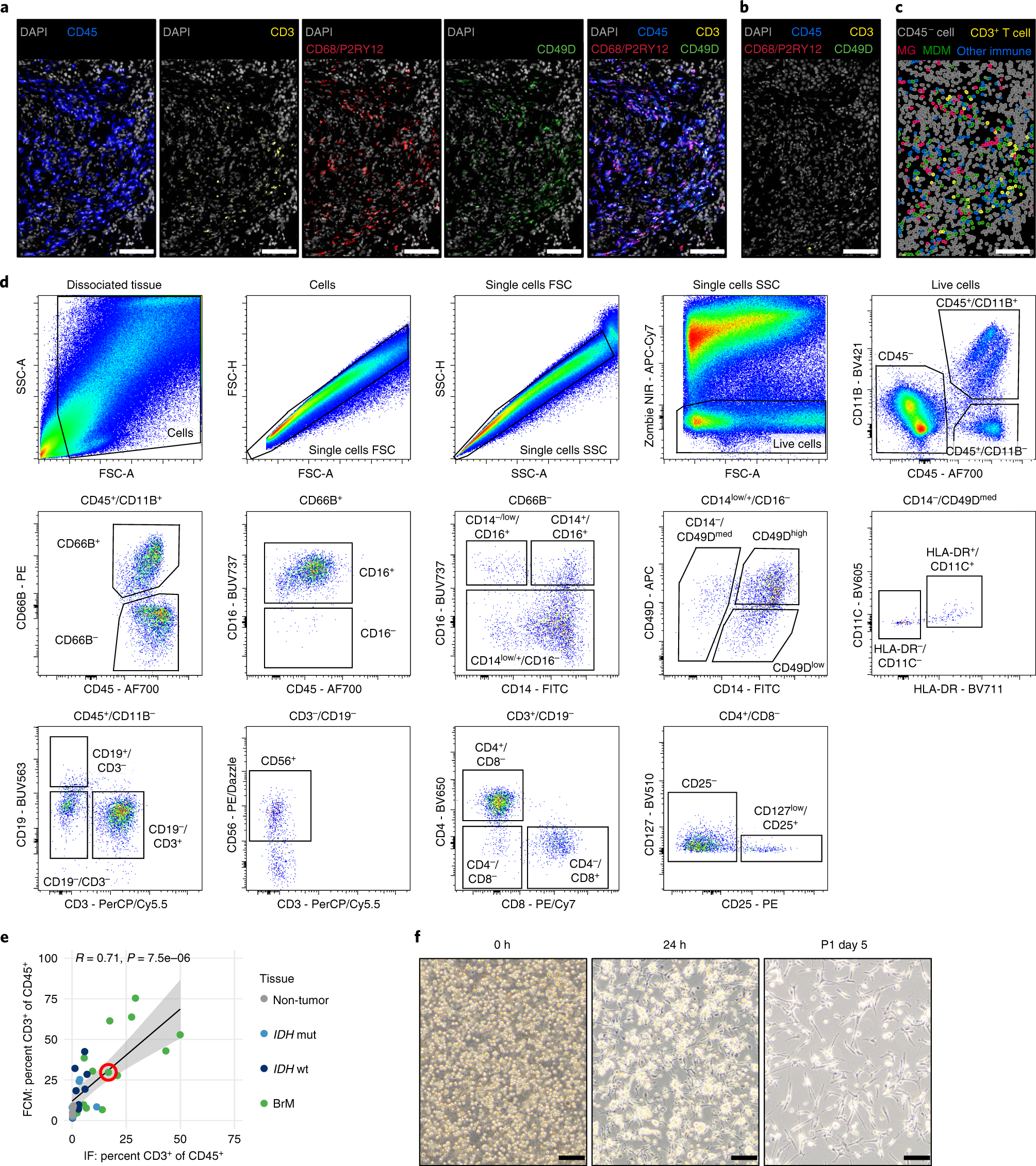 Fig. 8: Representative data from human brain tumor tissue.