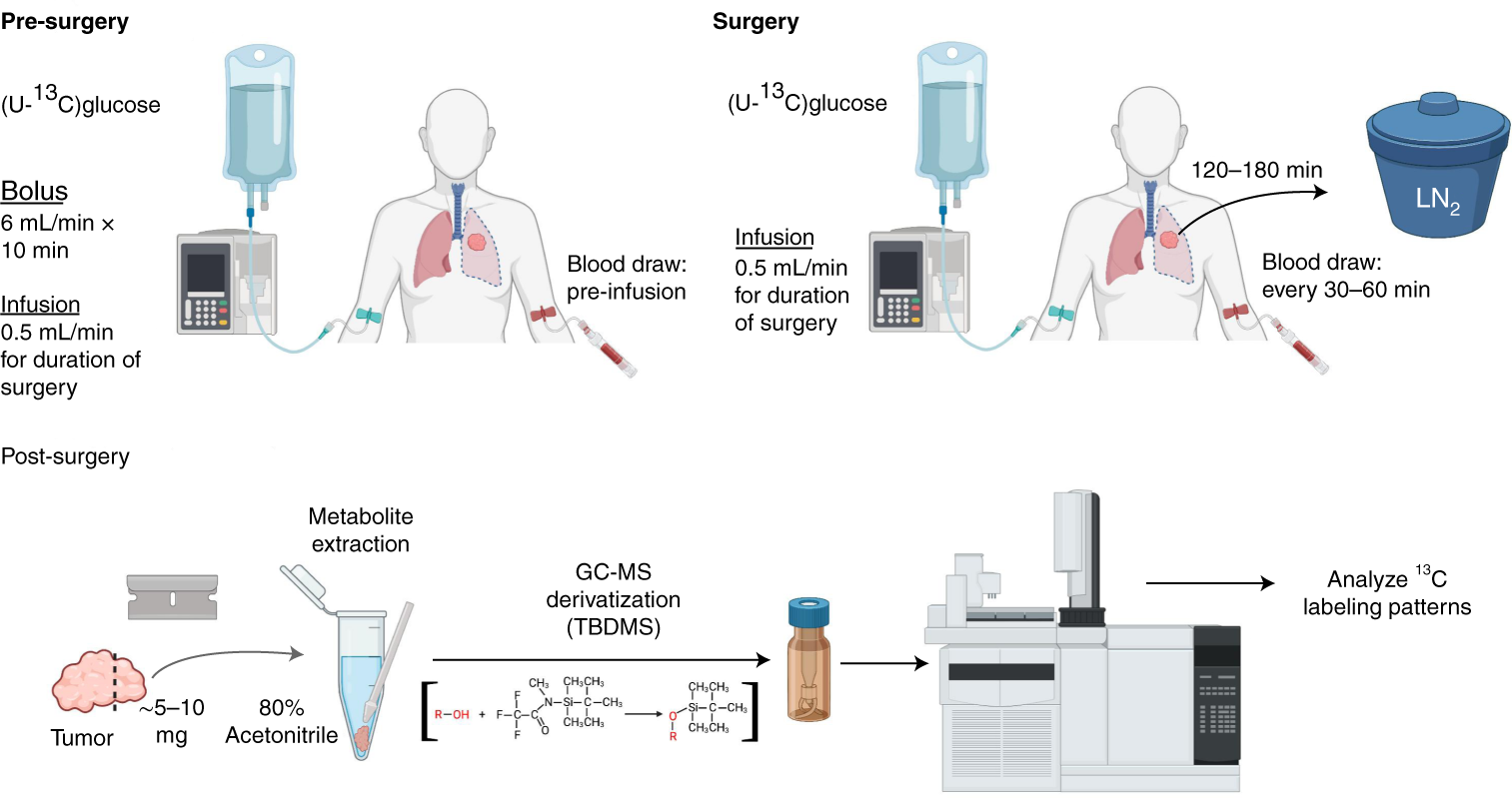 Fig. 1: Patient infusion workflow.