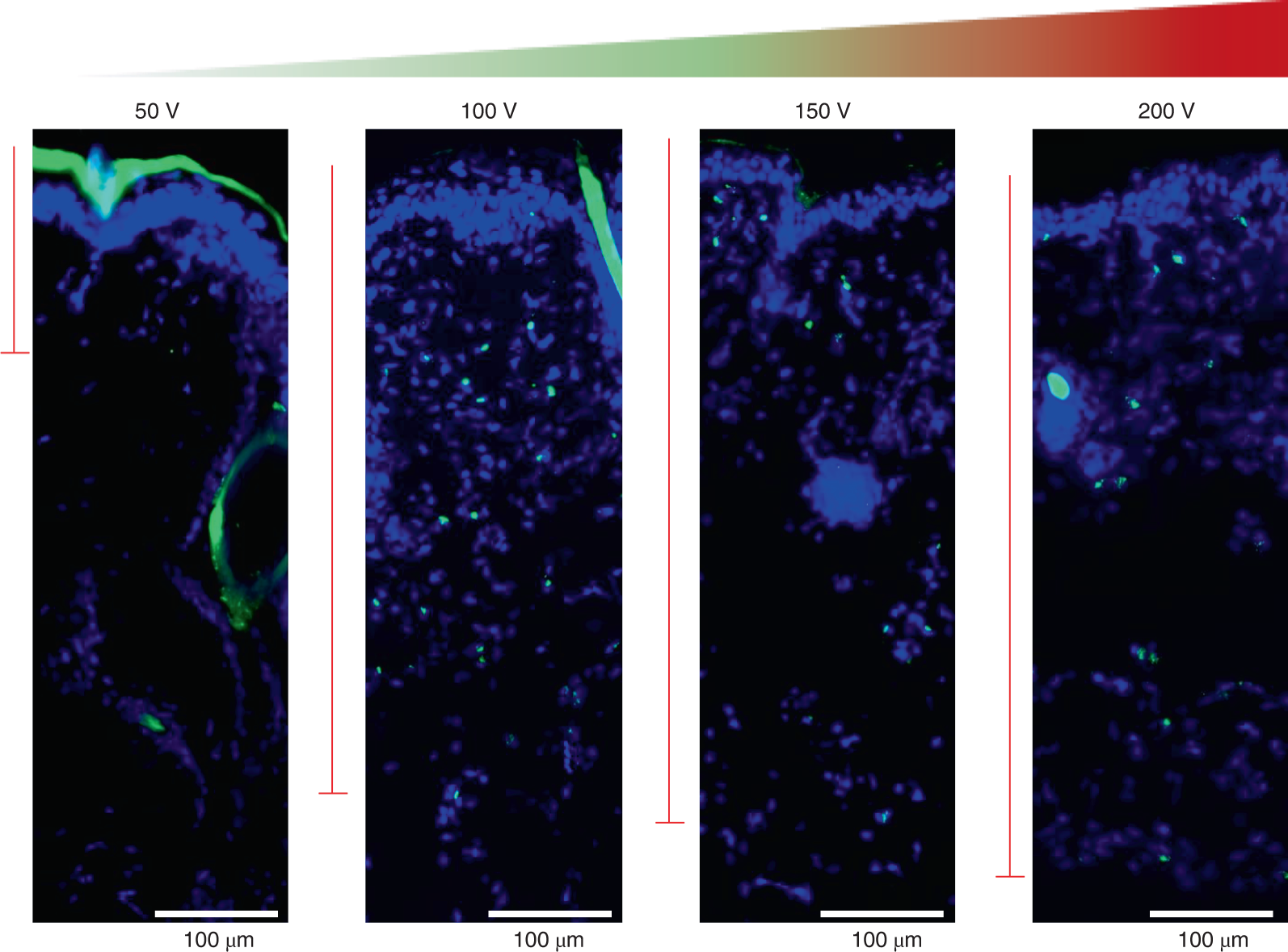Fig. 12: Depth of cutaneous gene delivery as a function of applied voltage.