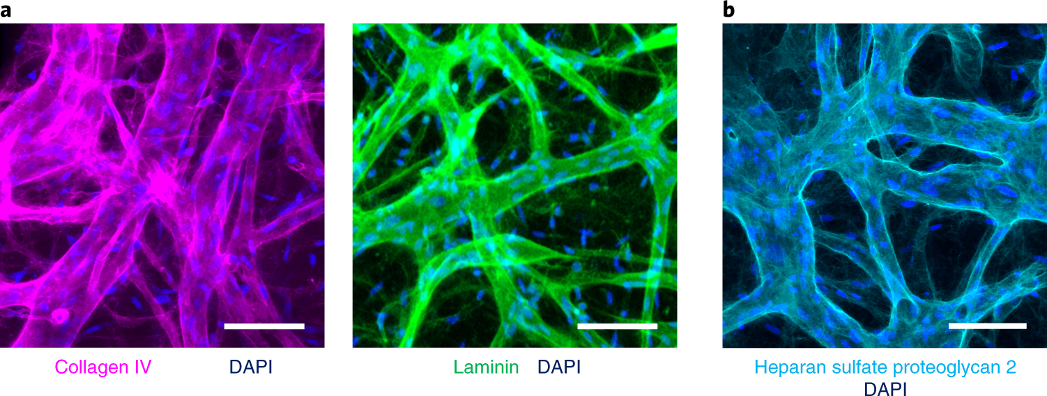 Fig. 10: Immunofluorescence staining for various proteins of interest in the BBB MVNs with iPS-ECs (Steps 52–59 in the protocol).
