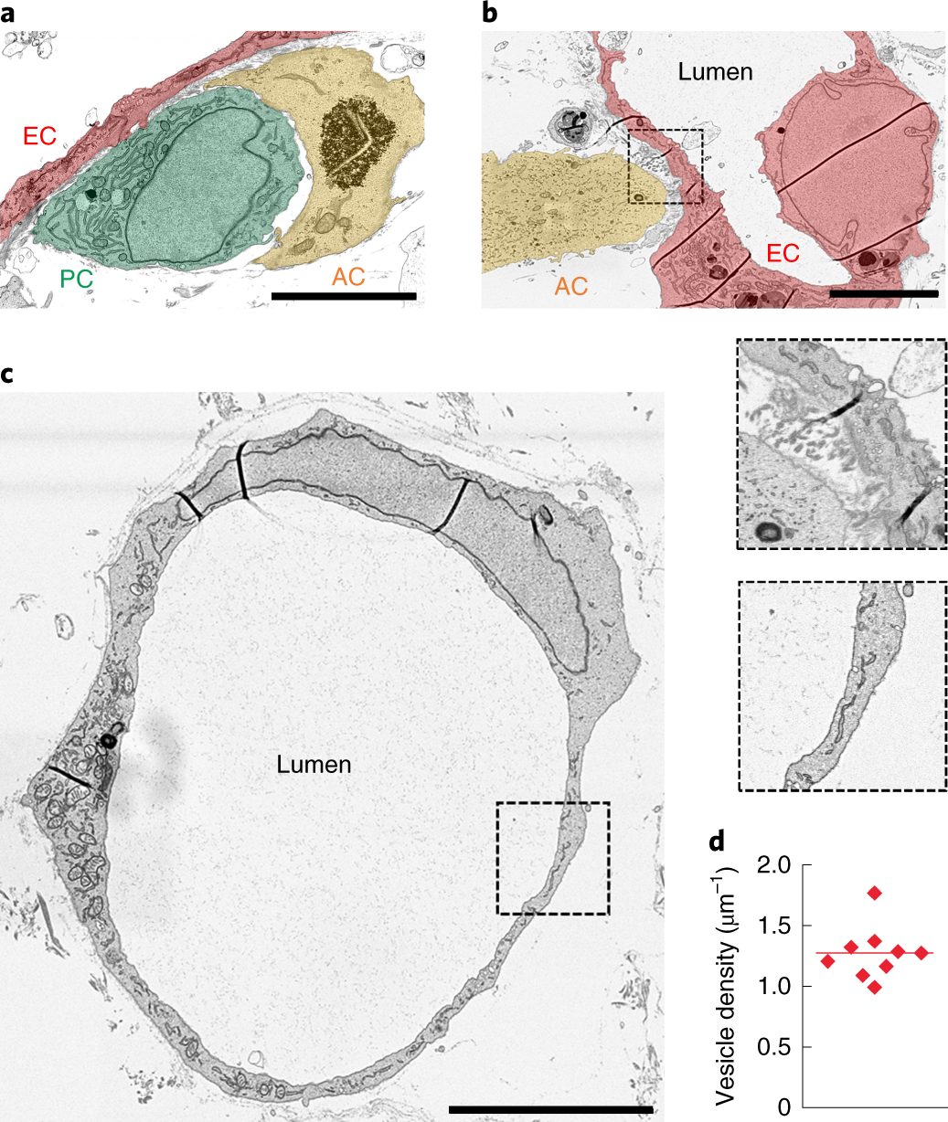 Fig. 11: Scanning electron microscopy images of histological sections collected from BBB MVNs fixed in 2% PFA, 2% glutaraldehyde in 0.15 M cacodylate buffer and sectioned using the methodology described in Fang et al.70.