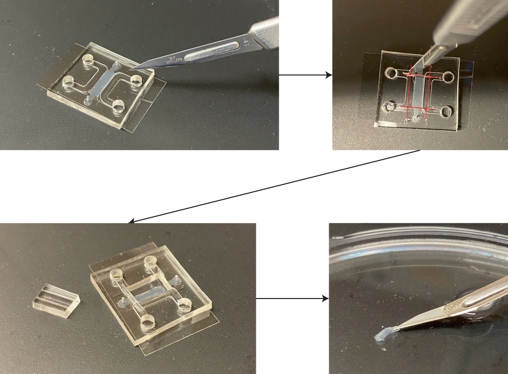 Fig. 8: Access and collection of the BBB MVN gel within PDMS microfluidic devices (Steps 62–64 in the protocol).