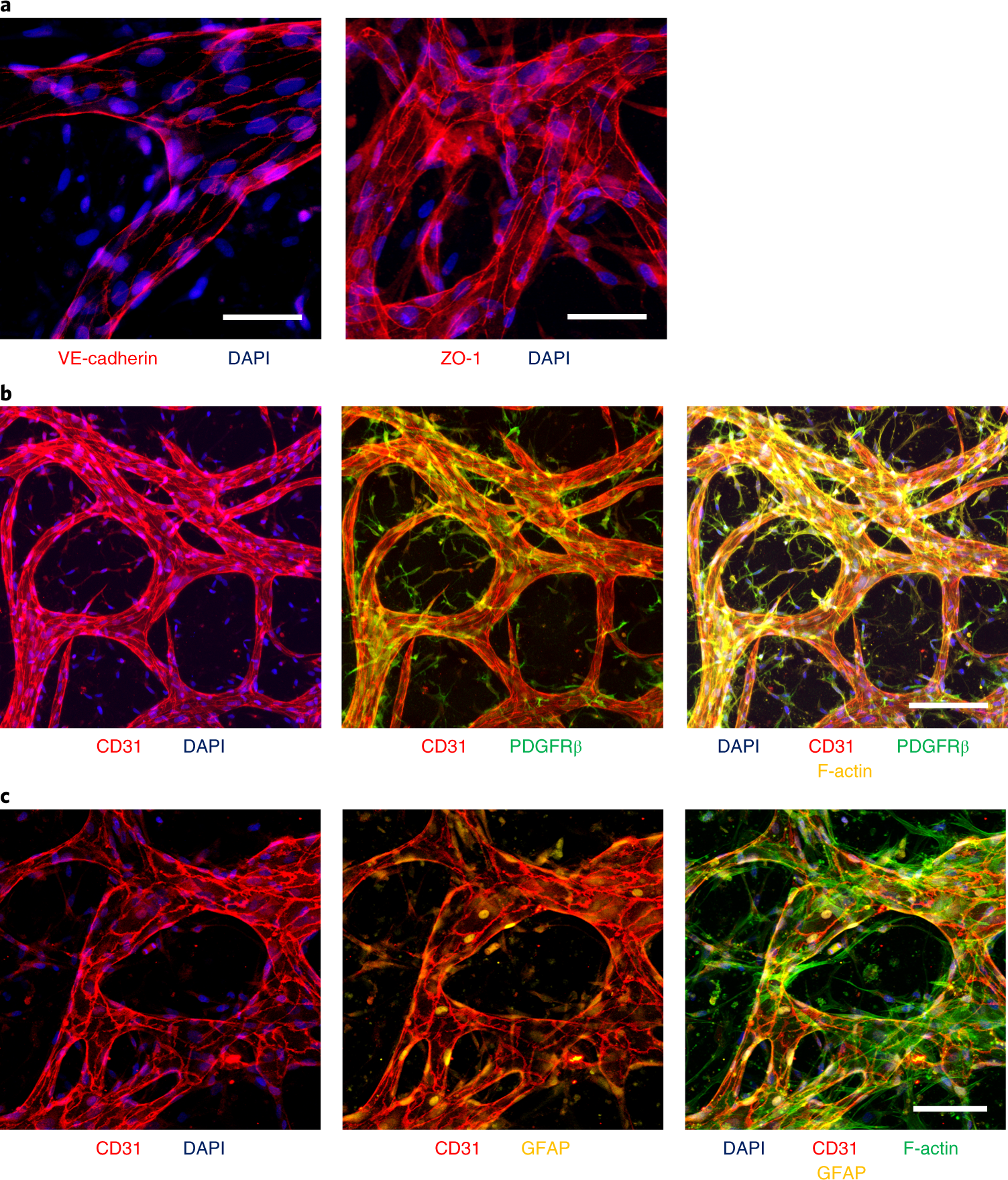 Fig. 9: Immunofluorescence staining for various proteins of interest in the BBB MVNs with iPS-ECs (Steps 52–59 in the protocol).