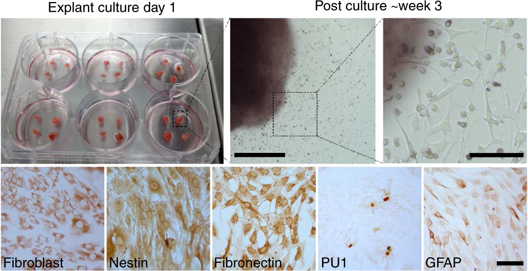 Fig. 10: Photomicrographs of leptomeningeal explant cultures.